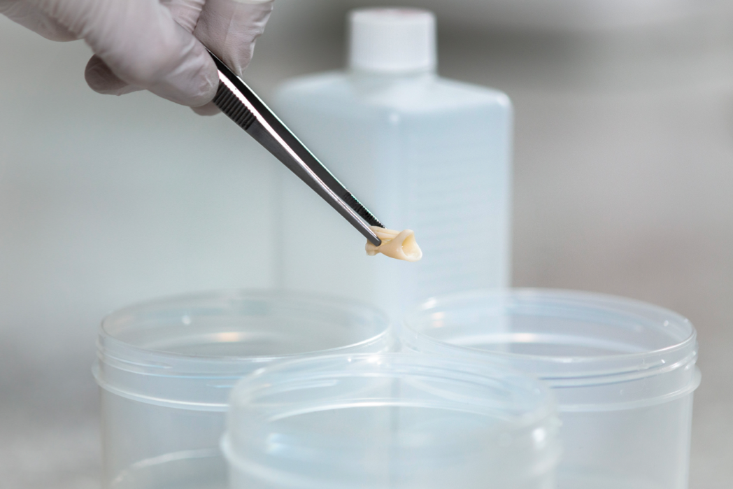 person putting tooth into petri dish with tweezers